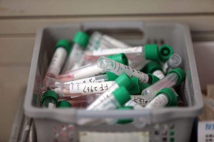 A view of the swab samples to be tested for SARS COV 2 at a hospital in Wuhan